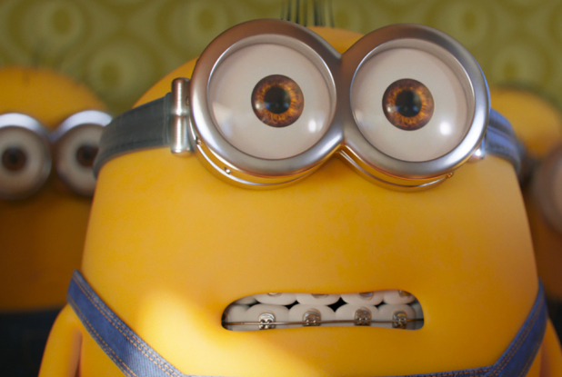 Minions 2 : Il était une fois Gru - Appareil dentaire
