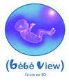 Bébé View